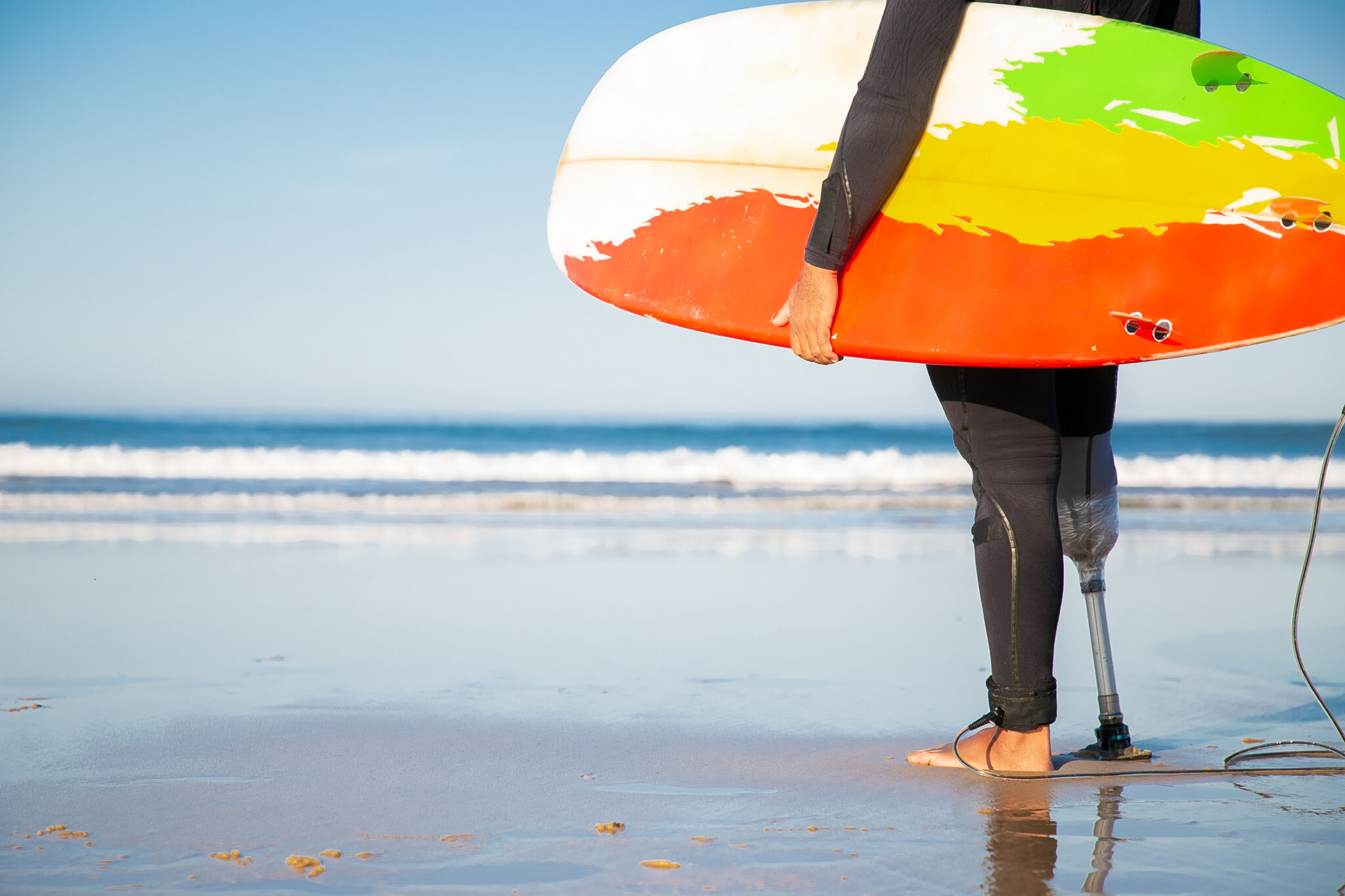 Back view of a male surfer standing with surfboard on the beach. The man is an amputee with an artificial leg looking at ocean waves. 