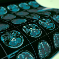 An image of a series of brain scans sitting on a table