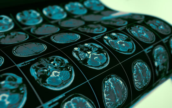 An image of a series of brain scans sitting on a table